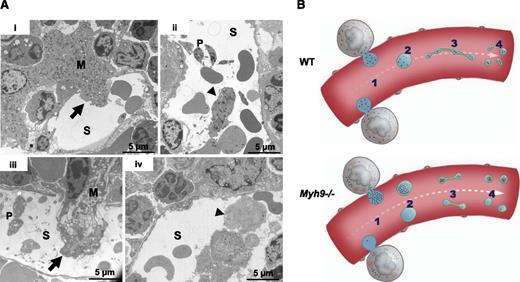 Figure 4. Abnormal distribution of organelles in Myh9−/− MK fragments shed into the sinusoids. (A) In situ bone marrow TEM images showing MKs in the process of shedding large fragments into a sinusoid (i,iii) (arrows) or fragments already released (ii,iv) (arrowheads). (i-ii) WT bone marrow; (iii-iv) Myh9−/− bone marrow. Note the fragment almost devoid of granules in Myh9−/− marrow (iv, arrowhead). S, sinusoid vessel; P, platelet. (B) Scheme recapitulating the importance of organelle positioning within MKs for normal organelle distribution within platelets. An impaired granule distribution in Myh9−/− MKs (1) leads to low-content or high-content preplatelet fragments (2) which are reorganized into low-content or high-content platelets (4), despite normal traffic along proplatelets microtubular tracks (3).