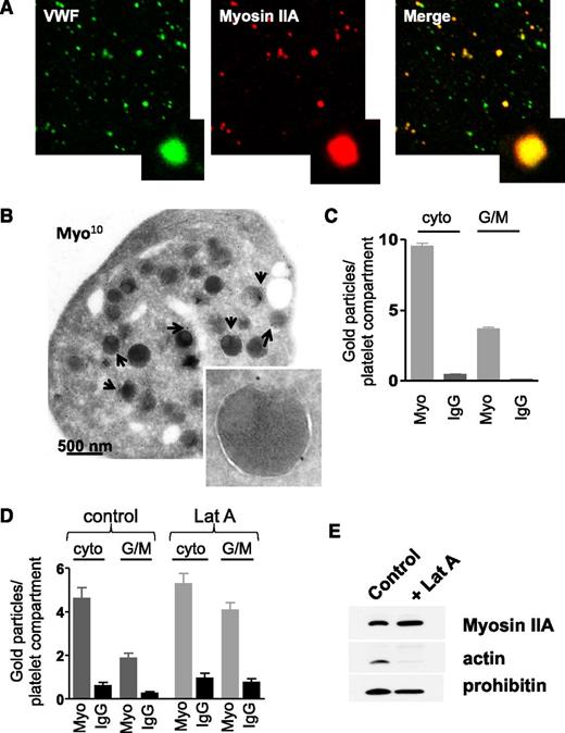 Figure 5. Presence of myosin IIA at the surface of platelet organelles. (A) Confocal observation of isolated human platelet organelles immunolabeled with anti-VWF antibody and anti-myosin IIA antibody showing the presence of myosin at the surface of VWF-positive α granules. (B) Immunogold labeling (anti-myosin IIA, 10 nm) of WT mouse platelets, showing the presence of myosin IIA at the cytoplasmic face of organelles. Inset, α granule labeled with 2 gold particles. (C) Quantification of the numbers of gold particles according to their localization in WT mouse platelets, either cytoplasmic or at the cytoplasmic face of granules or mitochondria. Results are mean ± SEM; n = 20-22 platelets. (D) Quantification of gold particles in human platelets treated or not with latrunculin A (100 µM). Data are mean ± SEM; n = 20. (E) Western blots performed on granules isolated from human platelets pretreated or not with latrunculin A (100 µM). While latrunculin A treatment removed F-actin from the surface of organelles, myosin IIA remained associated with organelles. Prohibitin, a mitochondrial protein, was used as a loading control and blots are representative of 3 separate experiments. cyto, cytoplasmic; G/M, granules or mitochondria; IgG, immunoglobulin G (isotype-matched control antibody); Lat A, latrunculin A; Myo, anti-myosin IIA antibody.