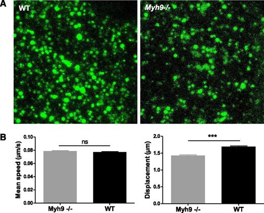 Figure 6. Impaired organelle motility in Myh9−/− MKs. (A) Cultured Myh9−/− and WT MKs were imaged using videomicroscopy after AF-488–fibrinogen incorporation. Image showing the maximal confocal projection of a MK cytoplasm portion (5.5 µm thickness). (B) Labeled organelles were tracked and their mean speed and displacement were measured. Only tracks that were longer than 25 seconds were evaluated to reliably determine the displacement. Data are mean ± SEM of 5260 (WT) and 3479 (Myh9−/−) granules from at least 3 independent experiments. ***P < .0001. ns, not significant.