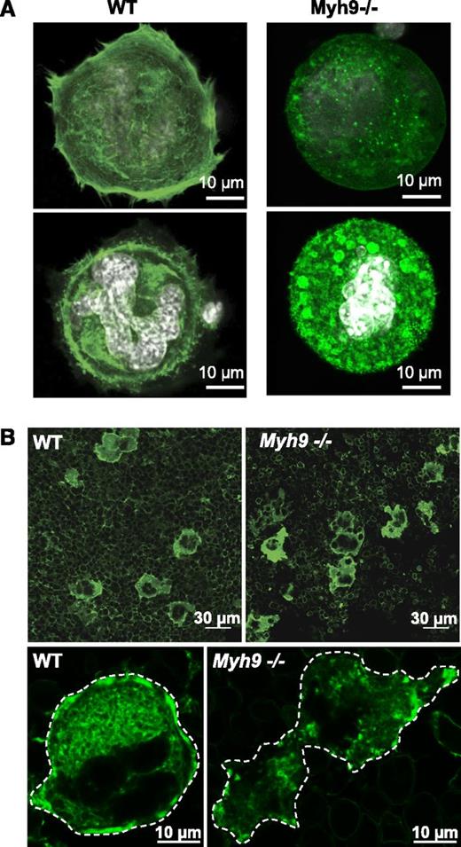 Figure 7. Defective actin organization in Myh9−/− MKs. (A) In vitro–differentiated WT and Myh9−/− MKs were allowed to adhere to fibronectin-coated coverslips for 1 hour and F-actin was visualized by AF-488 phalloidin labeling. Confocal images were taken at the base of a cell in contact with the coverslip (top panels) and in the plane of the white-labeled nucleus of the same cell (bottom panels). Images are representative of 3 independent experiments. (B) F-actin labeling of bone marrow using AF-488 phalloidin. (Top panels) Wide fields from WT and Myh9−/− marrow samples. (Bottom panels) Detail showing the F-actin distribution within a WT (left) and a Myh9−/− (right) MK. Dotted lines delineate the MKs. Images are representative of at least 3 different bone marrow samples for each genotype.