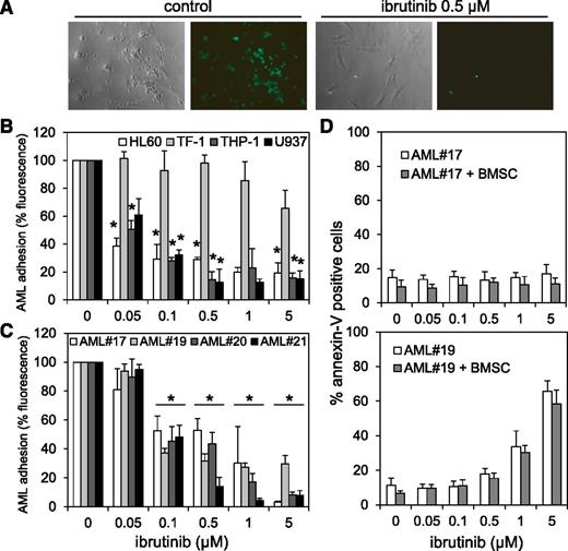 Figure 7. AML-BMSC adhesion and protection is disrupted by ibrutinib. (A) Light and fluorescence microscopic images show cocultured calcein-AM–treated THP-1 cells and BMSCs with and without 0.5 µM ibrutinib treatment for 8 hours. (B) Percentage of AML cell lines and (C) primary AML blasts attached to the primary AML BMSCs in the coculture setting in the presence and absence of various concentrations of ibrutinib for 8 hours. (D) AML blasts from AML #17 (low p-BTK) and AML #19 (high p-BTK) were left alone or cocultured with BMSCs in the presence or absence of various concentrations of ibrutinib for 48 hours and then stained for Annexin-V and analyzed by flow cytometry. In all panels, the values indicate the mean ± SD from 3 independent experiments. *Statistical significance of P < .05 between the different treatment groups.