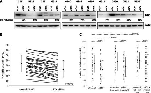 Figure 1. Specific knockdown of BTK impairs survival in CLL cells. (A) Knockdown of BTK by siRNA. Western blot analysis of BTK protein levels 72 hours after nucleofection with control or BTK-specific siRNA shows knockdown of BTK. This is representative of 37 patient samples. (B) CLL cell viability 72 hours after nucleofection with control or BTK siRNA. Following BTK knockdown, cells were cultured for 72 hours, and viability was determined at that time by percentage of cells negative for PI and Annexin V. Cells transfected with BTK siRNA had diminished viability compared with those treated with control siRNA. (C) Viability of CLL cells after transfection with BTK or control siRNA and coincubation with stromal cells or stimulation with IgM. BTK knockout reduced CLL cell viability even in the presence of stromal cells or after IgM stimulation.