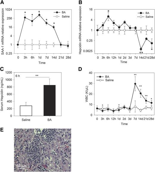 Figure 2. The B abortus–injected mice develop both acute and chronic inflammation, with an early rise in hepcidin mRNA. Compared with saline-injected mice, the B abortus–injected mice develop (A) increased SAA-1 mRNA by 3 hours, peaking at 1 day, and a gradual return to normal by 21 days; (B) increased hepcidin mRNA, with a peak at 6 hours, a slight but consistent increase through 7 days, followed by significant decrease at 14 and 28 days; (C) increased serum hepcidin protein at 6 hours; (D) increased WBCs by 7 days, with partial recovery by 28 days; and (E) hepatic perivascular infiltration of inflammatory cells by 7 days. (A-B) Means ± standard error, with each B abortus–treated group referenced to contemporaneous saline-treated group. (C-D) Means ± SD, *P < .05 and **P < .001 by Student t test or Mann-Whitney U test.