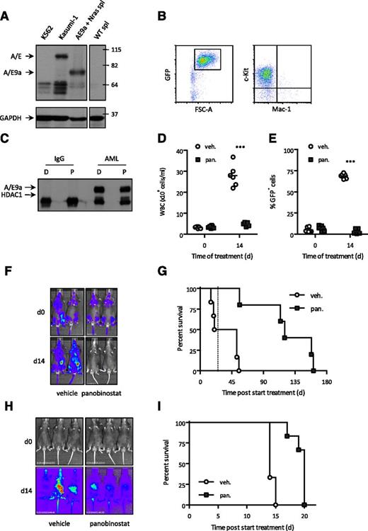 Figure 1. The HDACi panobinostat demonstrates therapeutic efficacy in a mouse model of A/E9a;NrasG12D-driven but not M/E;NrasG12D-driven AML. (A) Western blot analysis of whole-cell lysates prepared from cell lines K562 and Kasumi-1 and spleen cells (spl) isolated from a WT and an A/E9a;NrasG12D leukemia recipient mouse using an antibody to AML1 (upper panel). Membrane was stripped and reprobed for glyceraldehyde-3-phosphate dehydrogenase (GAPDH) as loading control (bottom panel). (B) Flow cytometry analysis of c-Kit and Mac-1 expression in GFP-positive spleen cells isolated from an A/E9a;NrasG12D leukemia recipient mouse. A representative flow cytometry plot is shown. (C) Immunoprecipitation/western blot analysis of the interaction between A/E9a and HDAC1 in A/E9a;NrasG12D leukemic cells treated with DMSO (D) or 16 nM panobinostat (P) for 6 hours. A control mouse immunoglobulin G (IgG) and antibody to AML1 (AML) were used for immunoprecipitation; antibodies to HDAC1 and AML1 were used for western blotting. The results shown are representative of 3 independent experiments. (D-F) Total white blood cells (WBC), flow cytometry analysis of leukemic cells in peripheral blood, and BLI of C57BL/6 mice bearing A/E9a;NrasG12D tumors treated with panobinostat or vehicle using the standard treatment regimen. In panels D and E, each data point represents an individual mouse, and horizontal bars represent mean value. ***P < .0001. (G) Kaplan-Meier survival curves of treated A/E9a;NrasG12D leukemia recipient mice following initiation of therapy (n = 6 for vehicle, n = 5 for panobinostat; median survival benefit 84 days, P = .0006). Dotted line indicates final day of treatment. (H) BLI of M/E;NrasG12D leukemia recipient mice treated with panobinostat or vehicle using the standard treatment regimen. (I) Kaplan-Meier survival curves of treated M/E;NrasG12D leukemia recipient mice following initiation of therapy (n = 6 for vehicle, n = 6 for panobinostat; median survival benefit 6 days, P = .0015).
