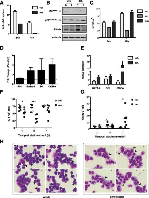 Figure 5. Panobinostat treatment of A/E9a;NrasG12D leukemic cells triggers differentiation. (A) Cell cycle analysis of A/E9a;NrasG12D leukemic cells treated in vitro with vehicle or 16 nM panobinostat for the indicated time. Percentage of cells in S phase (EdU positive) was determined by flow cytometry. Mean values of 2 independent experiments are shown; error bars represent standard deviation (SD). (B) Western blot analysis of whole-cell lysates prepared from A/E9a;NrasG12D leukemic cells treated in vitro with vehicle (D) or 16 nM panobinostat (P) for the indicated time using antibodies to p16INK4A, p21WAF1/CIP1, and phosphorylated RB. β-actin served as loading control. The results shown are representative of 3 independent experiments. (C) Flow cytometry analysis of c-Kit expression in A/E9a;NrasG12D leukemic cells treated in vitro with 16 nM panobinostat for the indicated time. Mean values of 3 independent experiments are shown; error bars represent SD. (D) Quantitative real-time PCR of relative mRNA levels of target genes in A/E9a;NrasG12D leukemic cells treated in vitro with 16 nM panobinostat for 24 hours. Results were normalized to HPRT mRNA. Mean value of 3 to 6 individual experiments is shown, and error bars represent SD. (E) Quantitative real-time PCR of relative mRNA levels of target genes in GFP-positive splenocytes isolated from A/E9a;NrasG12D leukemia recipient mice 72 hours after initiation of treatment with panobinostat (25 mg/kg) or vehicle (D5W). Results were normalized to HPRT mRNA. Mean value of 3 to 5 individual samples is shown, and error bars represent standard error of the mean. (F-G) Flow cytometry analysis of c-Kit (F) and Mac-1 (G) expression in GFP-positive bone marrow cells isolated from A/E9a;NrasG12D leukemia recipient mice treated with panobinostat (25 mg/kg) or vehicle (D5W) for 3 days. Data are combined from 2 individual experiments. Each data point represents an individual mouse, and horizontal bars represent mean value. (F) *P = .0248; ***P = .0009. (G) *P = .0292. (H) Light microscopy of May-Grunwald/Giemsa–stained bone marrow cells isolated from A/E9a;NrasG12D leukemia recipient mice cells treated with panobinostat (25 mg/kg) or vehicle (D5W, 250 µL) for 5 days. Imaging was performed with a ×60 objective. Representative images of 5 biological replicates are shown (bars represent 10 µm). GFP-positive cells isolated from 5-day vehicle-treated mice (left panel) demonstrate immature blast morphology, including a fine rim of agranular basophilic cytoplasm with a round to oval nucleus containing “open chromatin” and 1 or more prominent nucleoli (arrowheads). In contrast, GFP-positive cells from 5-day panobinostat-treated mice (right panel) show features of maturation including a reduction in the nuclear:cytoplasmic ratio, condensation of nuclear chromatin, and infrequent nucleolation. Frequent coarse azurophilic cytoplasmic granules (arrowheads) indicate myeloid differentiation.