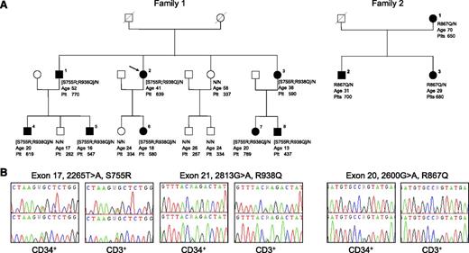 Figure 1. Clinical and molecular features of 2 pedigrees with hereditary thrombocytosis. (A) Filled symbols represent individuals with JAK2 germ-line mutations. Below each symbol is reported the JAK2 genotype with “N” indicating a normal allele, the age (years) at diagnosis for affected individuals or the age at last examination for asymptomatic relatives, and the platelet level (×109/L). (B) Sequence electropherograms of the germ-line JAK2 mutations.