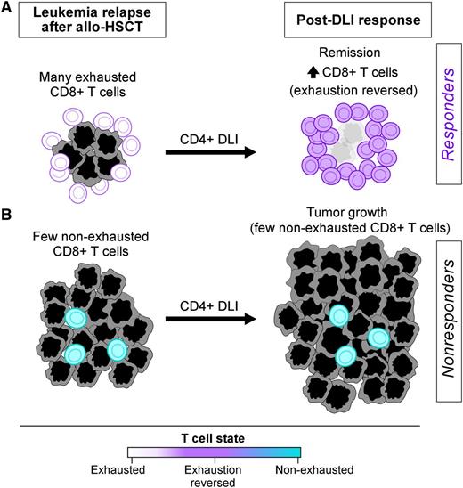 Figure 6. The proposed role of T-cell exhaustion in predicting clinical response to DLI. Our data support the idea that (A) response to DLI is associated with a preexisting reservoir of antitumor CD8+ T cells residing at the tumor site, to which CD4+ DLI provides immunologic help, not only to expand this reservoir but also to reverse T-cell exhaustion. The presence of T-cell exhaustion may signal that this reservoir exists. In contrast, in the absence of such a reservoir (B), a lack of DLI response is associated with both insufficient quantities of infiltrating T cells and the absence of phenotypic evidence of past T-cell activation.