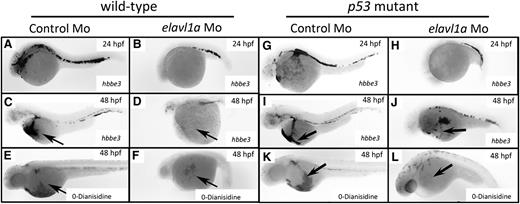 Figure 3. Erythropoiesis is defective in elavl1a morphants, regardless of p53 status. Whole-mount in situ hybridization was performed detecting hbbe3 transcripts at 24 hpf (A-B) or 48 hpf (C-D). Shown are representative embryos injected with elavl1a MO that displayed reduced hbbe3 transcript levels (27 of 33), compared with normal controls (38 of 40). (E-F) o-Dianisidine staining was used to detect hemoglobinized cells at 48 hpf. The representative elavl1a morphants show strikingly reduced hemoglobin staining (40 of 46), compared with normal embryos injected with control MO (60 of 60). (G-L) The same analyses were carried out using p53−/− embryos. All embryos are oriented lateral with anterior to the left.