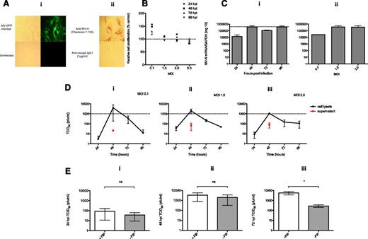 Figure 2. BM-MSCs support MV infection ex vivo and act as viable virus producing units. BM-MSCs were infected with MV-NSe-GFP at a range of MOIs, and assessed at 24-hour time points. (A) Representative images taken (Nikon Eclipse; TS100; ×20 objective) at 48 hours postinfection (hpi) at MOI 1.0 demonstrating (i) GFP positivity within multinucleate syncytia (uninfected cells as control) and (ii) cell surface MV-H glycoprotein expression (infected, isotype stained cells shown as negative control. Additional negative control was performed on uninfected cells (data not shown). (B) MTS colorimetric assay performed on infected BM-MSCs at 24-hour time points after infection for a range of MOIs. Mean values from 2 independent experiments carried out in at least triplicate are shown as a percentage of the mean values from uninfected controls. (C) Graph shows measles virus nucleocapsid (MV-N) RNA production by infected BM-MSCs at 24-hour time points postinfection with MOI of 1.0 (i) and at 48 hours postinfection for a range of MOIs (ii). Mean ± SEM. N = 3. (D) Graphs show TCID50 data for MV-infected BM-MSCs at 24-hour time points postinfection with MOIs of (i) 0.1, (ii) 1.0, and (iii) 2.0, performed on cell lysates and supernatants. For supernatants, all time points postinfection were tested, with virus only detectable at 48 hpi for all conditions. Mean ± SEM. N = 3 to 5. (E) Graphs show TCID50 data for BM-MSCs infected with MOI of 1.0 and cultured in the presence or absence of FIP. Data are for (i) 24 hpi (P = .4), (ii) 48 hpi (P = .25), and (iii) 72 hpi (*P = .05) and are shown as mean ± SEM. N = 3 to 5.