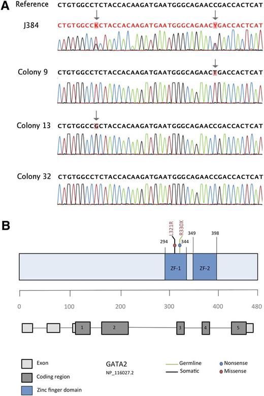 Figure 1. Identification of 2 distinct GATA2 mutations in patient J384. (A) Bidirectional sequencing of patient sample J384 revealed 2 distinct sequence variants in both the forward (shown here) and reverse strands. Sequencing of 40 individual colony picks after subcloning revealed that each sequence variant occurred in a trans configuration (CP9 and CP13 are shown here as examples). In addition, 10% of colony picks (ie, CP32) revealed a wild-type sequence, indicating that at least 1 of the 2 variants was a somatic event. (B) Schematic representation of the GATA2 gene highlighting the proposed germline and somatic mutations identified in patient J384. Both mutations are present in coding region 3, which translates to the zinc finger 1 region of the protein.