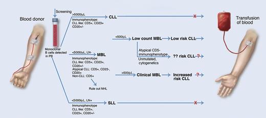 MBL in blood transfusion. Monoclonal B-cell lymphocytes are common in healthy blood donors and their detection may affect donor eligibility. MBL is defined as <5000 monoclonal B cells per μL of blood and no lymph node involvement. Low-count MBL (low risk of development of CLL, although risk may be affected by other factors) has <500 cells per μL and clinical MBL (increased risk of CLL) has >500 cells per μL. SLL, small lymphocytic leukemia. Professional illustration by Marie Dauenheimer.
