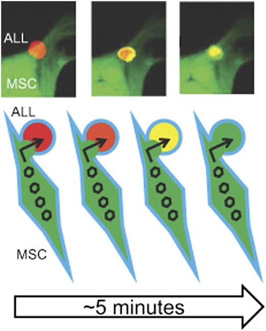 MSC delivery of MV to ALL cells. The top portion of the figure depicts live cell confocal microscopy showing the transfer (“handoff”) of GFP-expressing MV from a virus-loaded MSC (green) to an RFP-expressing Nalm-6 ALL cell. The ALL cells shift from red to yellow (and eventually green) fluorescence as more GFP-expressing virus enters within the RFP-expressing cell. Both cells will eventually undergo viral-mediated lysis. The bottom portion of the figure is a schematic representation of the cell MSC-ALL cell fusion and passage of GFP-expressing virus (open hexagon) into the RFP-expressing Nalm 6 ALL cell depicted by the red-orange-yellow-green color shift as the viral (green) fluorescence blends with and then overtakes the ALL cell (red) fluorescence. GFP, green fluorescent protein; RFP, red fluorescent protein. The top three panels have been adapted from Figure 4 in the article by Castleton et al that begins on page 1327.