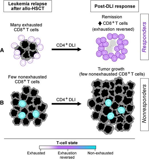 The extent of T-cell infiltration of the marrow and a gene expression profile indicating “exhaustion” in T cells are associated with response after DLI in patients with persistent CML after allogeneic hematopoietic cell transplantation. The number of donor CD8 cells that have previously infiltrated the marrow is higher in responders (A) than in nonresponders (B), and a gene expression profile indicating exhaustion is observed only in responders. See Figure 6 in the article by Bachireddy et al that begins on page 1412.