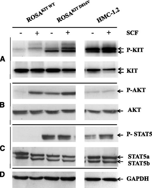 Figure 4. Detection of spontaneous phosphorylation of KIT, AKT, and STAT5 in ROSAKIT D816V cells by western blotting. Cell lysates from unstimulated ROSA cell lines and from the HMC-1.2 cell line or from the same cells stimulated for 10 minutes with rhSCF were subjected to electrophoresis in sodium dodecyl sulfate polyacrylamide gel electrophoresis and treated with Abs against (A) anti-human total KIT or p-KIT Y719, (B) anti-human total AKT or p-AKT S473, or (C) anti-human total STAT5 or p-STAT5 Y694. (D) An anti-human glyceraldehyde-3-phosphate dehydrogenase (GAPDH) was used as a loading control. The lanes were run on the same gel but were noncontiguous.