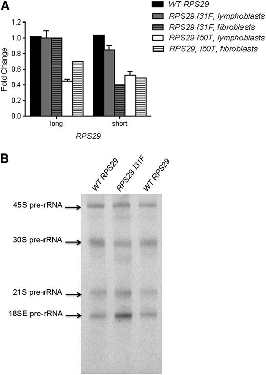 Figure 3. Functional assays for the RPS29 mutations. (A) Quantitative RT-PCR for RPS29 expression was performed on peripheral blood–derived lymphoblasts and primary fibroblast RNA samples from the proband from family NCI-193 (p.I31F) and family NCI-38 (p.I50T) and an unaffected control individual WT RPS29. The figure shows the combined data from 3 plates for lymphoblasts, and data for 1 plate for the fibroblasts, normalized using 2 endogenous controls (ACTB and GAPDH), for the short and long isoforms of RPS29. (B) Northern blot analysis of pre-rRNA processing was performed with a hybridization probe to 18SE/ITS1 (probe γ) using activated lymphocytes9 recovered from the peripheral blood from the proband (III-3) in family NCI-193 (p.I31F) and an unaffected control individual with WT RPS29.
