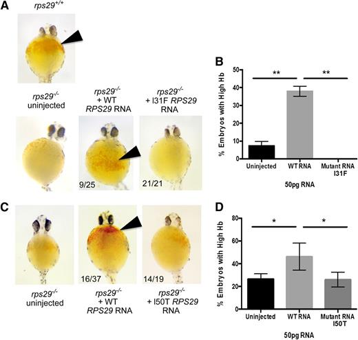 Figure 4. Zebra fish as a DBA model of the RPS29 mutations. (A) The Hb phenotype of zebra fish embryos with WT rps29+/+, rps29−/− uninjected embryos, rps29−/− embryos injected with WT human RPS29 RNA, and rps29−/− embryos injected with the p.I31F mutant human RPS29 RNA from the proband (III-3) in family NCI-193. The numbers of zebra fish embryos displaying this phenotype are shown (ie, 9 of 25 injected and 21 of 21 injected). (B) The percent of rps29−/− zebra fish embryos with high Hb are shown for the uninjected embryos, WT human RPS29 RNA–injected embryos, and the p.I31F mutant human RPS29 RNA–injected embryos. (C) The Hb phenotype of embryos injected with the p.I50T mutant human RPS29 RNA. (D) The percent of embryos with high Hb. *Student t test P < .05; **Student t test P < .01.