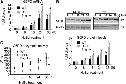 Figure 5. G6PD expression and enzymatic activity in cells from patients with G6PD deficiency (def) in response to HDACi. (A) G6PD mRNA levels in WT and G6PD-Brighton B-cell lines after treatment with 3 mM NaBu over 36 hours. (B) G6PD protein levels assessed by western blotting (top; representative of 1 of 3 independent experiments is shown) and quantified (n = 3; bottom). (C) G6PD enzymatic activity assessment at the corresponding time points.