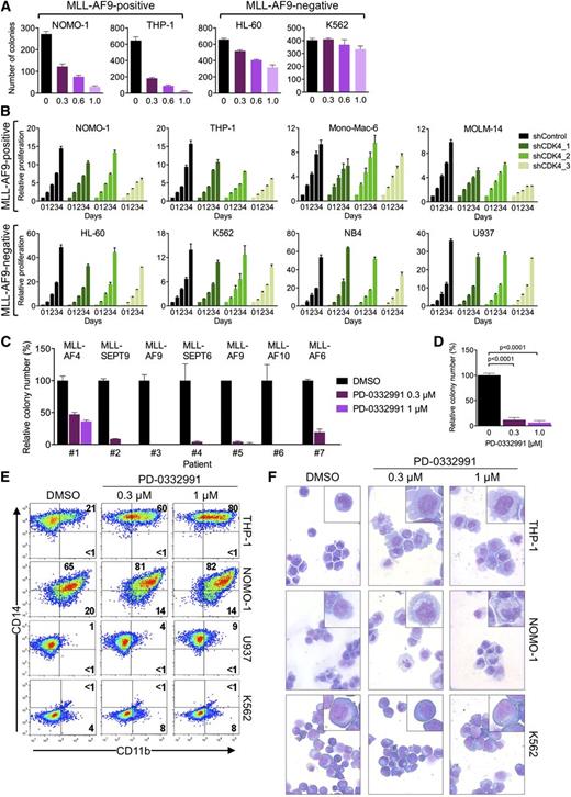 Figure 5. Pharmacologic inhibition of CDK6 in human AML cells. (A) Colony formation of AML cell lines treated with PD-0332991. (B) Effects of CDK4 suppression in AML cell lines. (C) Relative colony numbers of primary human MLL-rearranged AML specimens cultured in the presence of PD-0332991. (D) Cumulative analysis of normalized colony data shown in panel C. (E) Flow cytometric analysis of myeloid differentiation in AML cell lines treated with PD-0332991. Numbers indicate percentages of cells. (F) Microscopic analysis of May-Grünwald-Giemsa–stained cytospin preparations of AML cell lines treated with PD-0332991. Original magnification, ×400. Insets show twofold magnified details of the corresponding photographs.