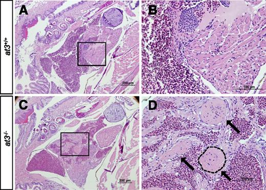 Figure 2. Loss of At3 results in adult intracardiac thrombosis. (A-D) at3−/− fish die in association with large intracardiac thrombi. H&E-stained cardiac sections from wild-type clutchmates (A-B) and at3Δ90 homozygous mutants (C-D). The boxed regions in panels A and C are shown at higher magnification in panels B and D, respectively. Sections were photographed with an Olympus BX-51 upright light microscope using an Olympus DP-70 digital camera. Three large thrombi present in panels C and D are indicated by arrows in panel D. One thrombus is outlined. Scale bar 200 µm (A,C), 100 µm (B,D). H&E, hematoxylin and eosin.
