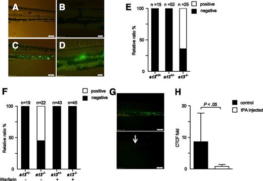 Figure 6. at3−/− mutants display fibrin deposition, consistent with DIC. Fluorescent deposits were observed in the PCV in at3−/− mutant larvae after FITC-labeled fibrinogen injection. All data shown are from Δ90 mutants and were collected by an observer blinded to genotype and/or treatment. (A-B) Images of at3+/+ and (C-D) at3−/− larvae postinjection. Scale bars: (A,C), 100 µm; (B,D), 20 µm. (E) Percentage of larvae identified without (black) or with fluorescent PCV deposits (white), derived from at3+/− incrosses or at3+/− × at3−/−. Data are from 3 separate experiments. (F) Effects of warfarin pretreatment on at3−/− larvae prior to FITC-labeled fibrinogen injection demonstrate that fluorescence deposition is inhibited by anticoagulation. (G) Effects of tPA on at3−/− larvae post FITC-labeled fibrinogen injection. Presence of fluorescent venous deposits seen prior to injection of tPA (top) were significantly diminished post tPA injection (bottom). Scale bars: 100 µm. Arrow indicates minor residual fluorescence. (H) Quantification of CTCF of at3−/− larvae post tPA injection. Control, n = 7; tPA injected, n = 6. Error bars represent standard deviation and statistical significance was determined by an unpaired t test. Larvae were visualized on an inverted microscope Olympus IX71 with 40× objective and images were acquired with a charge-coupled device camera (Olympus DP72, cellSens software 1.3). CTCF, corrected total cell fluorescence.
