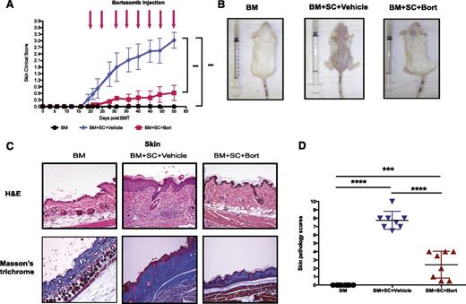 Figure 1. Therapeutic bortezomib administration protects mice from sclerodermatous cGVHD responses. Irradiated (800 cGy) recipient BALB/c mice received bone marrow cells (8 million) with or without spleen cells (25 million) intravenously from donor B10.D2 mice. Mice were then randomized allocated to treat with either vehicle (PBS) or bortezomib (0.1 mg/kg) intraperitoneally at day 20 after transplant and every 5 days thereafter. (A) Skin clinical scores (on a scale of 3.9) were evaluated twice a week. (B) Photographs were taken at day 55 after HSCT from either bone marrow only or GVHD mice treated with vehicle or bortezomib at day 20. (C) (Upper) Pathologic examination of skin by hematoxylin and eosin stain. (Lower) Collagen deposition and fibrosis were examined by Masson’s trichrome stain. (D) Pathological scores (on a scale of 10) were evaluated by pathologists in a blind code fashion. Data are shown as mean ± standard error of the mean (SEM) and analyzed by 1- or 2-way ANOVA with a Tukey post hoc test to compare between individual groups. *P < .05, **P < .01, and ***P < .001 were considered significant. Data were collected from 2 independent experiments with 8 mice per group.
