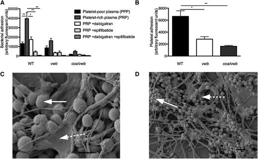 Figure 3. Platelets increase S aureus adhesion under shear stress. (A) Microparallel flow chamber perfusions over coated collagen with fluorescently labeled WT, vwb, and coa/vwb strains in the presence of plasma and platelet-rich plasma (preincubation 37°C for 15 minutes) at 1000 seconds−1. Addition of dabigatran (500 nM) or eptifibatide (7.5 μg/mL) where indicated (n ≥ 5). (B) Perfusion over coated collagen with WT, vwb, and coa/vwb strains in platelet-rich plasma at 1000 seconds−1. Platelets were labeled with rhodamine-G (preincubation 37°C for 15 minutes). Adhesion of platelets was lower when perfused with a strain lacking vWbp compared with WT and was further reduced when perfused together with a mutant strain lacking both coagulases (vwb/coa) (n ≥ 4). All results are expressed as mean ± SEM. *P < .05, **P < .01. (C) SEM image (×20 000) of WT perfusion in PRP over collagen at 1000 seconds−1, illustrating the interactions among bacteria, fibrin, and platelets. Bar represents 1 μm. (D) SEM image (×5000) of WT perfusion in PRP over collagen at 1000 seconds−1. Bar represents 2 μm. Full white arrows indicate bacteria; dotted white arrows indicate platelets.