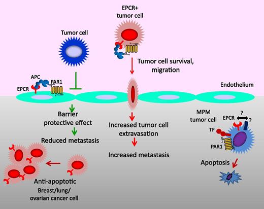 Figure 6. Multiple effects of EPCR on cancer. In the vasculature, the EPCR-APC–mediated signaling pathway on the endothelium provides an antimetastatic effect by inhibiting the extravasation of tumor cells through down-regulation of vascular adhesion molecules on the endothelium that are involved in tumor cell adhesion and by enhancing barrier integrity of the endothelium. EPCR on tumor cells may increase the metastatic potential as EPCR-APC signaling promotes tumor cell survival, migration, and invasion. In the tumor compartment, EPCR, in general, promotes tumor growth and burden through its survival benefits. However, in malignant pleural mesothelioma (MPM), EPCR suppresses tumor growth by promoting tumor cell apoptosis and/or inhibiting tumor cell proliferation. At present, it is unclear whether specific receptor(s) present on MPM cells or the pleural microenvironment is responsible for the EPCR-mediated tumor cell apoptosis in MPM. TF, tissue factor; PAR1, protease activated receptor-1.