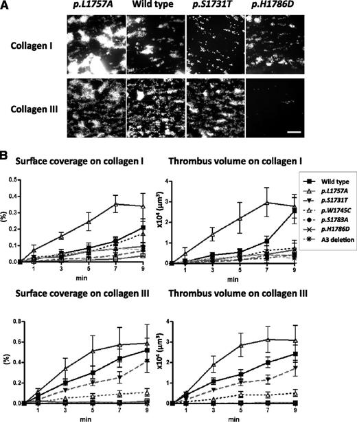 Figure 3. r-mVWF mediated platelet adhesion under physiologic high shear. (A) Impact of collagen-binding mutants on collagen I or III surface under high shear conditions. Whole blood from VWF knockout mice containing DiOC6 (1 μM)–labeled platelets, anticoagulated with argatroban, was perfused over a type I or III collagen and recombinant mouse VWF-coated chamber under high shear rate (2500 S−1). Representative images of collagen-binding mutants at 7 minutes after perfusion. p.L1757A showed accelerated platelet adhesion on both collagen I and III surfaces. p.S1731T and p.H1786D showed decreased platelet adhesion. These images were constructed from spinning disk confocal laser scanning microscopy–based data on successive horizontal slices. The images are representative of 4 flow experiments. Scale bar, 50 μm. (B) Flow-based analysis of platelet adhesion. Statistical analyses corresponding to the images in panel A. Error bars represent mean (± standard deviation) surface coverage and total thrombus volume in the flow experiments. Thrombus generation with the p.L1757A gain-of-function variant is accelerated and enhanced, whereas the loss-of-function mutants showed various degrees of functional deficit (n = 5).