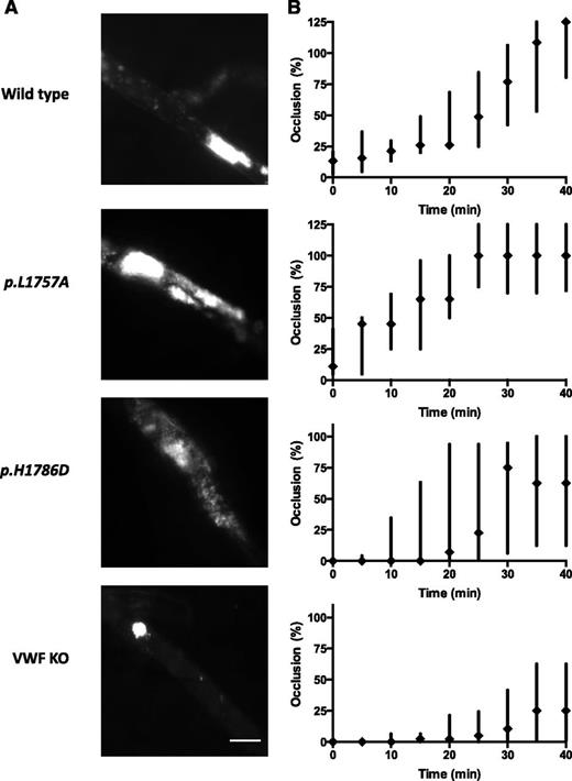 Figure 6. In vivo assessment of VWF:CB variants using a ferric chloride-induced cremasteric arteriolar injury model. (A) Evaluation of thrombus size in the ferric chloride injury model. The cremaster muscle was exteriorized and platelets were labeled by the injection of rhodamine 6G via the catheter placed in the jugular vein. Thrombosis was induced by the application of 10% ferric chloride for 3 minutes. The injured area was observed for 40 minutes. Representative images of indicated group at 30 minutes after injury were shown. Scale bar, 50 μm. (B) Occlusion time course of collagen-binding VWF variants. Intravital microscopy was performed with the VWF−/− mice expressing WT or collagen-binding mutant-mVWF via hydrodynamic injection. The p.L1757A gain-of-function mutant showed enhanced thrombus generation. In contrast, the p.H1786D loss-of-function mutant showed decreased thrombus generation. Thrombus generation was most reduced in the VWF−/− mice. However, even in these animals, residual thrombus activity of ∼25% occlusions were documented (n > 6). Scale bar, 50 μm.