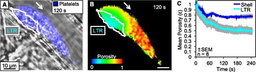 Figure 4. Dynamics of thrombus regional porosity. Albumin labeled with Alexa Fluor 488 was infused into the mouse prior to injury and the fluorescence was monitored within the lumen, LTR, and shell of the developing thrombi. (A) A representative image of platelets (blue) and LTR (white outline) 120 seconds postinjury. (B) For the same thrombus, a pseudo-colored image of the thrombus colored to represent the porosity based on the normalized fluorescence intensity. (C) Average porosity of the shell (blue) and LTR (cyan) of 8 individual injuries over 240 seconds postinjury.