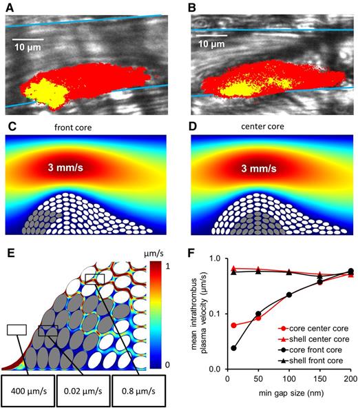 Figure 3. Heterogeneous gap size distribution. Based on experimental data (A-B), 2 different architectures were designed with a subset (the core) of more tightly packed platelets at the front (C) or in the center (D) of the hemostatic plug. The smallest gaps are 200 and 10 nm between white and gray platelets, respectively. In all cases, the inlet vessel velocity is modeled like a pressure-driven parabolic profile with a maximum velocity of 2 mm/s. (E) Sample regions in a prethrombus area, behind core platelets (gray) and shell platelets (white) with their respective computed velocity magnitudes. (F) Average intrathrombus plasma velocity computed for geometries with the core in the front (black) or middle (red). Platelet packing density, but not the core location, determines the average velocity between platelets.