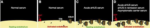 (A) Resting endothelium is protected against complement activation by complement regulators. (B) Normal serum deposited small amounts of C3b (and C3b degradation products) and C5b-9 on ADP-activated endothelial cells, but complement regulatory proteins presented in normal serum inhibited propagation of complement activation on the surface of endothelium. (C) In the presence of serum from a patient with acute aHUS, complement regulation on endothelial cells is ineffective, resulting in a larger number of C5b-9 complexes deposited on the surface of resting endothelium. (D) Serum samples from patients with acute aHUS, aHUS in remission, and healthy carriers of complement mutations deposited C5b-9 on the surface of ADP-activated endothelial cells. In this assay, HMEC-1 were used as the source of endothelial cells.