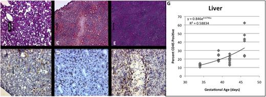 Figure 2. Development of hematopoietic ontogeny in FL by immunohistochemistry. (A,C,E; ×20, H&E) Shows the structural maturation and expansion of CD45+ cells (B,D,F; ×20, anti-CD45 immunoperoxidase). At 33 days (A-B), the tissue appears immature, and relatively few CD45+ cells are apparent. By 39 days (C-D), CD45+ cells begin to appear, and by 46 days (E-F), obvious vascular architecture and a more mature histologic appearance correspond with a significantly increased concentration of CD45 hematopoietic cells and CD34+ progenitors. Scale bars represent 50 μm. Again, flow cytometry confirms the presence of CD45+ hematopoietic progenitors throughout the period of analysis, increasing exponentially with cellular division (G).