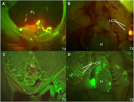 Figure 4. Fluorescence stereomicroscopic comparison of donor cell distribution at 48 hours postinjection of PKH-67–labeled BM cells. (A) Fetal abdomen after IP injection. (B) Fetal thorax after IP injection. (C) Fetal abdomen after IC injection. (D) Fetal thorax after IC injection. Note the persistence of donor cells in the peritoneal cavity and paucity of engrafted donor cells in the FL after IP injection. In contrast, the FL and intercostal vascular bundles have large numbers of engrafted and circulating PKH+ cells following IC injection. H, heart; I-CV, intercostal vessels.