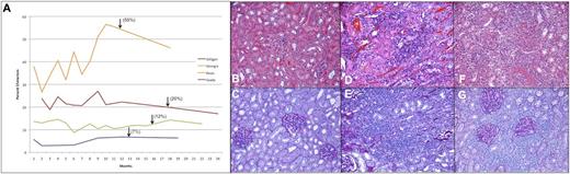 Figure 6. Renal transplantation following IUHCT. Chimerism profile of renal allograft recipients, with arrows marking the time of transplantation (A). Evaluation of the kidney allograft in tolerant animals at 6 months reveals no evidence of rejection on H&E (B) or PAS (C). In the nonchimeric control dog, there is evidence of acute rejection with significant and severe lymphocytic infiltrate, inflammation, and tubulitis on H&E (D) and PAS (E) upon transplant nephrectomy 5 days following transplantation. This animal manifested an early and acute Systemic Inflammatory Response Syndrome reaction characterized by fevers, anorexia, and weight loss, consistent with acute rejection observed histologically and requiring urgent explant, upon which all symptoms resolved. In this animal, gross examination of the kidney revealed a markedly shrunken and discolored appearance. In the animal with the lowest chimerism levels (3% to 7%), there was persistent lymphocytic infiltrate on both H&E (F) and PAS (G) at 6 months, consistent with Banff class 3 subclinical chronic rejection; no clinical sequelae were noted, and the animal remained healthy throughout the planned 6-month observation. Upon gross examination, this allograft had a normal appearance. All images ×20.