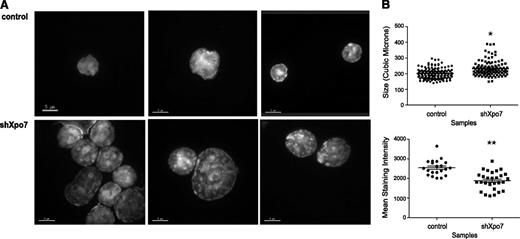 Figure 4. Xpo7 knockdown significantly disrupts erythroid terminal nuclear condensation. (A) Erythroblasts infected with control or Xpo7 shRNA imaged at 48 hours of culture. Cells were stained with DAPI and imaged at 100× using confocal fluorescent microscopy. (B) (Upper) Quantification of volume of nuclei, measured by calculation of area for each Z-stack slice of confocal images in A, and (Lower) average DAPI intensity per combined deconvoluted 2-dimensional image.