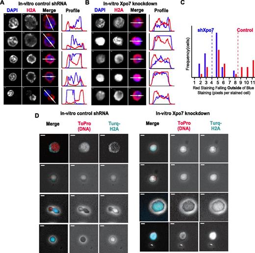 Figure 5. The migration of nuclear proteins such as histones out of the nucleus during normal erythroid differentiation is inhibited by Xpo7 knockdown. (A-B) Immunofluorescence of cultured erythroblasts after 48 hours of culture containing shRNA against either (A) control or (B) Xpo7. Red staining is against histone 2A using an Alexa-594 secondary antibody and blue staining is against DNA (DAPI). Note that there is less red staining overlying the nuclei in the control shRNA-infected cells and increased accumulation in the cytoplasm, but in contrast, after Xpo7 knockdown, histone staining remains colocalized with the nucleus. In all panels, scale bar = 10 μm. (C) Histogram of amount (pixels per cell) of cytoplasmic, or noncolocalized with DAPI, red staining in cultured control (red) or Xpo7-KD (blue) cells at 48 hours. Mean noncolocalized red staining (pixels per cell) for 35 cells is depicted as a dotted line (control, 8.49; shXpo7, 4.00). There is significantly more staining outside of the nucleus in control cells compared with Xpo7-KD cells (Student t test, P < .001). (D) Immunofluorescence of cultured erythroblasts after 48 hours of culture containing shRNA against either control or Xpo7 and a plasmid containing a histone H2A-mTurquoise fusion protein. Red staining shows nuclear DNA using ToPro dye, and turquoise depicts localization of the fusion protein. There is less turquoise staining over the nucleus in control shRNA-infected cells (and more in the cytoplasm), whereas in Xpo7-KD cells, red and turquoise staining colocalize.