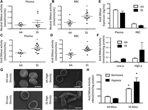 Figure 2. SMase activity in SCD. (A) Neutral SMase activity in plasma and (B) RBCs. (C) Acid SMase activity in plasma and (D) RBCs. (E) Acid SMase expression in plasma and RBCs. (F) Acid SMase activity in high- and low-density RBCs (labeled “high ρ” and “low ρ, ” respectively), and (G) representative SEM images of RBCs. (H) Acid SMase activity in whole blood of AS/SS mice immediately after 8 hours normoxic/hypoxic conditioning. *P < .05 measured with an analysis of variance (ANOVA) relative to AA or AS normoxia.