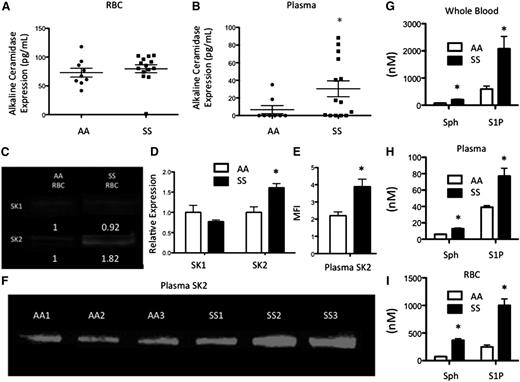 Figure 3. Alkaline CDase, SK, Sph, and S1P in SCD. (A) ACER1 expression in RBCs and (B) plasma. (C-D) SK1 and SK2 expression from equal amounts of RBC protein. (E-F) SK2 levels from equal amounts of plasma protein. (G-I) Sphingosine and S1P levels in whole blood (G), plasma (H), and RBCs (I). *P < .05 measured with a Student t test relative to AA.