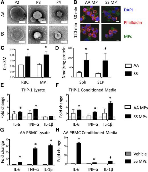 Figure 4. RBC-derived MPs and monocyte crosstalk. (A) Transmission electron microscopy images of P2 (10 000g), P3 (37 000g), and P4 (200 000g) MPs. Scale bar = 200 nm. (B) Internalization or CFSE-labeled P3 MPs by PMA-treated THP-1s. Scale bar = 10 μm. (C) Ceramide (Cer) and SM quantification with HPLC-MS. (D) Sphingosine and S1P quantification in RBCs and MPs. (E) Fold change over vehicle in cytokine production, and (F) secretion of PMA-treated THP-1s after non-SCD microparticle (AAMP) and SCD microparticle (SSMP) incubation relative to untreated cells (dotted line). (G) Fold change over vehicle in cytokine production, and (H) secretion of primary AA monocytes after SSMP incubation relative to untreated cells. *P < .05 measured in ANOVA relative to vehicle or AA.