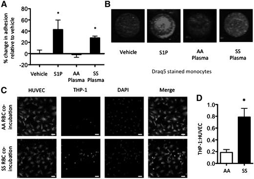 Figure 5. Elevated monocyte adhesion in SCD. (A-B) Monocyte-adhesion after 1 hour with 1 μM S1P, AA plasma, or SS plasma treatment of AA PBMCs. Representative fluorescent images showing adherent DRAQ5 labeled THP-1 cells after 4 hours of adhesion to HUVECs (B). (C-D) RBCs co-incubated with THP-1 monocytes (10:1) for 18 hours. Representative confocal images (C) and monocyte:HUVEC ratio after 4-hour adhesion (D). *P < .05 measured with 1-way ANOVA or Student t test relative to vehicle or AA.
