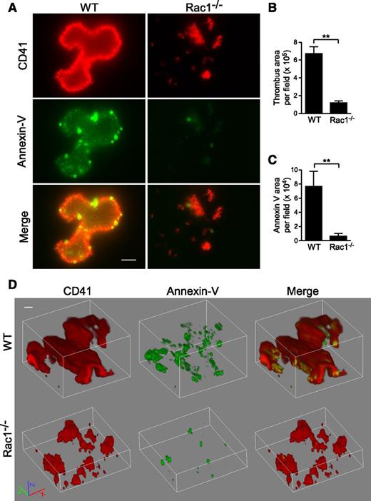 Figure 6. Rac1 is important for the exposure of PS during thrombus formation in vitro under shear. Washed WT and Rac1−/− platelets were stimulated with 0.03 U/mL thrombin and subjected to shear (6000 seconds−1) over a fibrinogen-coated surface. Platelets (red) were stained using anti-mouse CD41 and Alexa Fluor-546–conjugated anti-rat antibodies. Surface-exposed PS (green) was stained using Alexa Fluor-488–conjugated Annexin V. (A) Representative fluorescence microscopy images showing WT and Rac1−/− platelet thrombi (red) and exposed PS associated with thrombi (green). Scale bar represents 10 μm. (B) Quantification of surface area of thrombi per field (mean ± SEM, n = 7). (C) Quantification of the Annexin V surface area per field (mean ± SEM, n = 7). (D) Representative 3-dimensional reconstruction of confocal Z-stack images of WT and Rac1−/− platelet thrombi and exposed PS. Scale bar represents 10 μm. Movies of confocal Z-stack images of WT (supplemental Movie 1) and Rac1−/− (supplemental Movie 2) platelet thrombi and exposed PS are provided. For all data, ** represents statistical significance of P < .01.