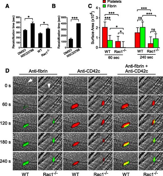 Figure 7. Platelet Rac1 is important in promoting fibrin generation in vitro and in vivo. (A) The mean recalcification time ± SEM of human citrated PRP treated with 100 µM NSC23766 (n = 20) or vehicle control (n = 10) and of washed WT and Rac1−/− mouse platelets (n = 5) resuspended in citrated human PPP after addition of CaCl2 under stirring conditions. (B) The recalcification time of human citrated PRP treated with 100 µM NSC23766 or DMSO was monitored using a cone-plate rheometer under defined shear (6000 seconds−1) after addition of CaCl2 (mean ± SEM, n = 4). (C-D) Intravital microscopy was used to monitor fibrin generation (green) and platelet thrombi (red) in vivo following laser-induced cremaster arteriole wall injury in WT and platelet-specific Rac1−/− mice. (C) The sizes of the platelet thrombus and fibrin clot were compared by calculating their respective median surface area at 60 and 240 seconds (median + interquartile range). (D) Representative images of fibrin generation (green) and platelet thrombi formation (red) and merged images. Arrows indicate direction of blood flow. Movies comparing laser-induced platelet thrombus formation and fibrin deposition in WT (supplemental Movie 3) and platelet-specific Rac1−/− mice (supplemental Movie 4) mice, as well as the median integrated fluorescence signals of platelet thrombi and fibrin as a function of time (supplemental Figure 4), are provided. For all data, * and *** represent statistical significance of P < .05 and .001, respectively.