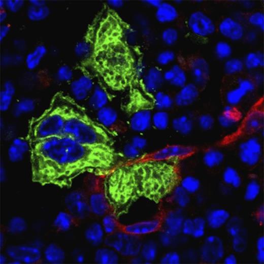 Proplatelet extension across the endothelial barrier (red) and subsequent release of (pre)platelets by megakaryocytes (green), as occurring in bone marrow sinusoids in vivo, has been very difficult to reproduce in vitro. The microfluidic bioreactor design by Thon and colleagues now recapitulates many critical aspects of this process, enabling platelet production and its high-resolution real-time visualization in vitro.1 Bone marrow cryosection was probed with anti-CD105 (Alexa Fluor 647; red), anti-GPIb (Alexa Fluor 488; green) antibodies and counterstained with 4′,6 diamidino-2-phenylindole (blue).