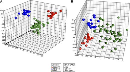 Figure 1. PCA of gene and miRNA expression microarray data. The PCA graph of global gene expression data (A) and PCA graph of global miRNA expression data (B) were computed using Partek GS, version 6.6; BM control samples are shown as red spheres; PB control samples are shown as blue spheres; PMF samples are shown in green. PMF JAK2 wild-type samples are shown as pyramids, and PMF JAK2V617F samples are shown as prisms.
