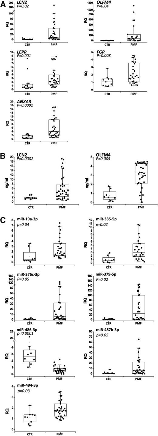 Figure 2. Validation of the selected genes and miRNAs in granulocytes and plasma from PMF patients. (A) Expression of the 7 selected genes in granulocytes from PMF patients and healthy donors. Gene expression levels were measured by qRT-PCR starting from granulocyte total RNA and were expressed as relative quantity (RQ). Boxes represent the interquartile range that contains 50% of the subjects, the horizontal line in the box marks the median, and the bars show the range of values. Data are representative of 32 PMF and 12 control (CTR) samples. (B) Serum levels of 2 secreted proteins (LCN2 and OLFM4) in PMF patients and healthy donors. Protein levels were measured by enzyme-linked immunosorbent assay (ELISA) and were expressed as ng/mL. Boxes represent the interquartile range that contains 50% of the subjects, the horizontal line in the box marks the median, and the bars show the range of values. Data are representative of 30 PMF and 8 CTR samples. (C) Expression levels of the 8 selected miRNAs in granulocytes from PMF patients and healthy donors. The miRNA expression levels were measured by qRT-PCR starting from granulocyte total RNA and were expressed as RQ. Boxes represent the interquartile range that contains 50% of the subjects, the horizontal line in the box marks the median, and the bars show the range of values. Data are representative of 32 PMF and 12 CTR samples. *P < .05 vs CTR.