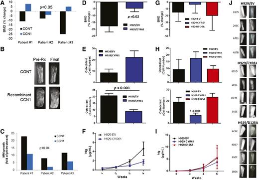 Figure 6. CYR61 prevents bone loss and reduces tumor burden in the SCID-hu mouse model. In the first experiment (A-C), CD138-selected primary MMPCs from 3 patients were injected (100 000/mouse) into implanted bones in SCID-hu mice and were treated with recombinant CCN1. Pretreatment (CONT) and post-CCN1 treatment (CCN1) groups were compared. In the second set of experiments (D-F; 10 mice/group) and (G-J; 8 mice/group), H929 cells transduced with empty vector (EV), CYR61 complementary DNA (CYR61) or CYR61 with mutated αvβ3-binding domain (D125A) were injected (100 000 cells/mouse) into implanted bones in SCID-hu mice. (A,D,G) Change in BMD of the myelomatous bones from preengraftment levels (B,J) Radiographs of human bones implanted in SCID-hu mice before start of therapy (column 1) and at the end of the study (column 2) for each treatment group. (C,F,I) Serum hIg was quantitated by ELISA as a measure of tumor growth. (E,H) Numbers of osteoblasts (positive for osteocalcin staining) and osteoclasts (positive for TRAP staining).