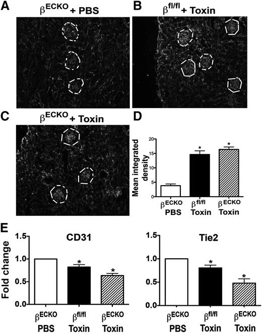 Figure 2. Cytotoxin injury of glomerular endothelium induces glomerular microvascular injury. (A-C) Mice were treated as in Figure 1, then frozen sections of kidney were stained with anti-mouse fibrinogen/fibrin antibody. The fluorescence intensity among regions of interest drawn around Bowman’s capsule containing the glomerular microvessels (white line) was measured using ImageJ (D). Each bar represents mean ± SEM; n ≥ 5 mice per group; *P < .05, toxin-treated groups vs PBS control group. (E) Quantification of EC transcripts from total RNA extracted from the renal cortex. The real-time PCR data were analyzed using the δCt method. Each bar represents mean ± SEM; n ≥ 5 animals per group; *P < .05, toxin-treated groups vs PBS control group.