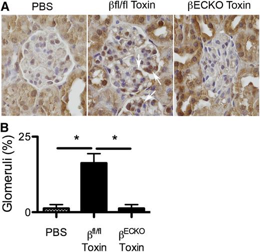 Figure 7. PI3Kβ loss inhibits the induction of apelin expression in vivo. Wild-type littermates or βECKO mice were treated with the lectin-saporin cytotoxin as in Figure 1, then kidney tissue was harvested at day 3 and immunostained for apelin expression (A). Uninjured kidney glomeruli show little apelin staining. Toxin-mediated EC injury induces glomerular apelin expression (middle panel, arrows) in wild-type, but not βECKO, mice. The frequency of glomeruli expressing apelin is quantitated (B) (mean ± SEM; n = 4 mice/group; *P < .05 by ANOVA).
