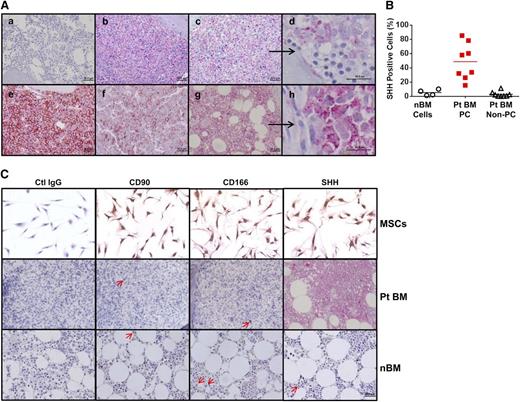Figure 1. Expression of SHH in BM biopsy samples from MM patients and healthy donors. (A) Immunohistochemistry staining for SHH in BM samples of (a) 1 of 4 healthy donors or (b,c,e,f,g) 1 of 5 MM patients. Higher magnifications—in (d), they were derived from the (c) field (black arrow) or in (h), they were derived from the (g) field (black arrow)—show that SHH staining was observed only in MM plasma cells but not in non–plasma cells or BM hematopoietic cells. (B) Percentages of SHH-positive cells in normal BM (nBM cells) from 4 healthy donors and SHH-positive MM plasma cells (Pt BM PC) or MM non–plasma cells (Pt BM non-PC) from 8 MM patients (Pts). (C) Morphology and staining for CD90, CD166, and SHH in cultured MSCs (upper panels), MM patients’ BM samples (Pt BM; middle panels), and normal BM samples from healthy donors (lower panels). Only very few CD90+ or CD166+ MSCs or SHH-expressing cells (indicated by red arrows) could be detected in patient BM or normal BM. Ctrl, control.